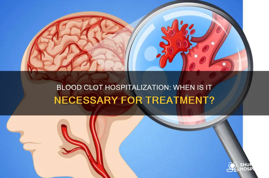 do you have to be hospitalized for a blood clot