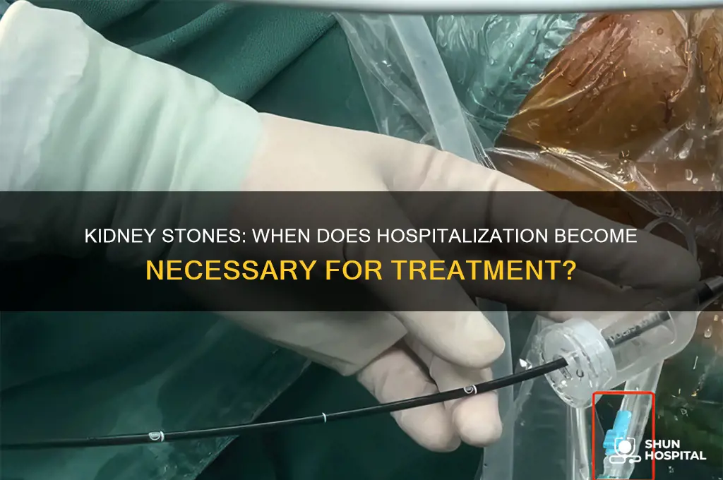 do you have to be hospitalized for kidney stones