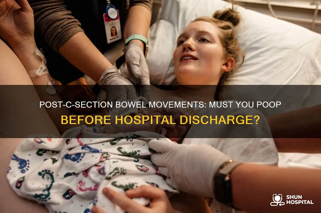 do you have to poop before leaving hospital after c-section