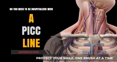 Understanding PICC Line Care: Is Hospitalization Always Necessary?