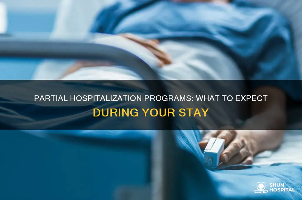 do you stay at the hospital for a partial progrm