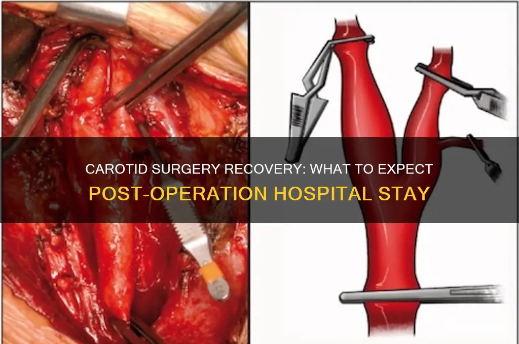 do you stay in the hospital after carodid surgury