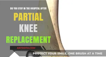 Partial Knee Replacement Recovery: Hospital Stay or Outpatient Procedure?