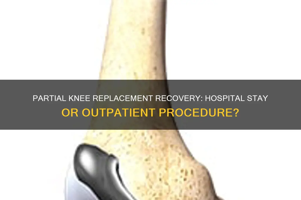 do you stay in the hospital after partial knee replacement