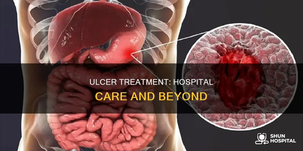 do you treat ulcers in the hospital