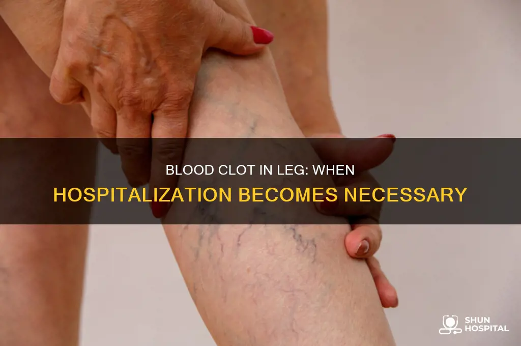 does a blood clot in the leg require hospitalization