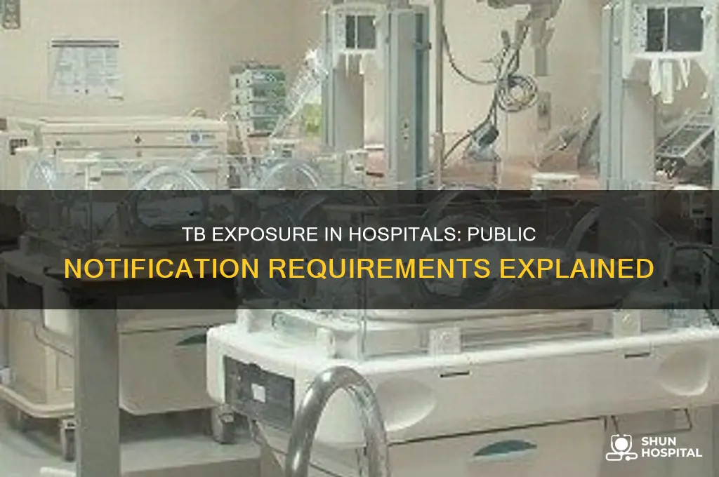 does a hospital have to notify public of tb exposure