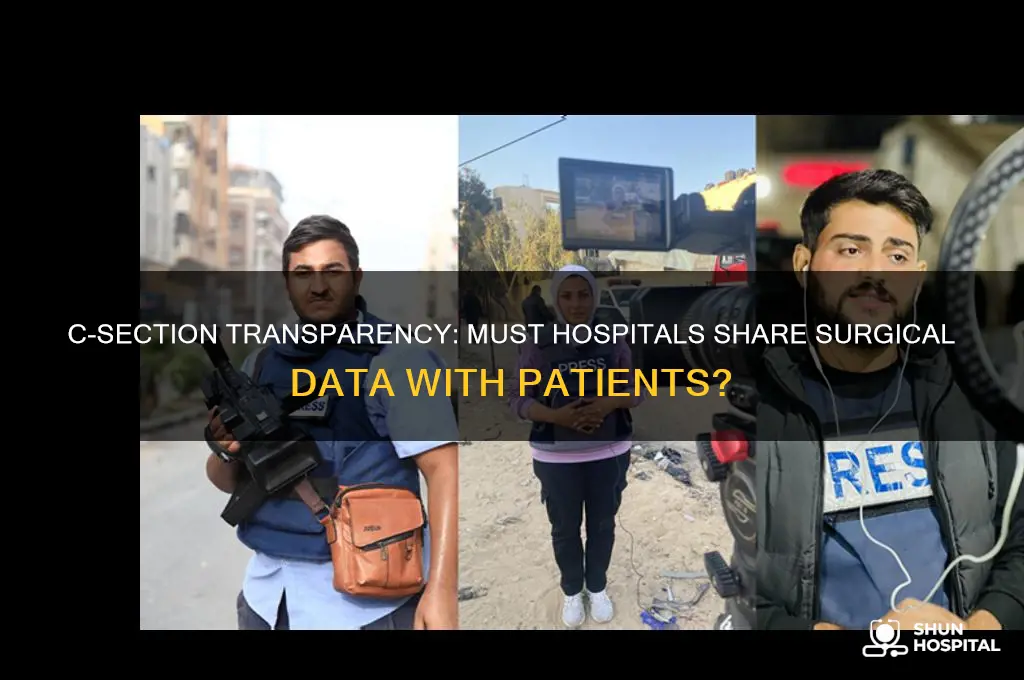 does a hospital have to share c section data