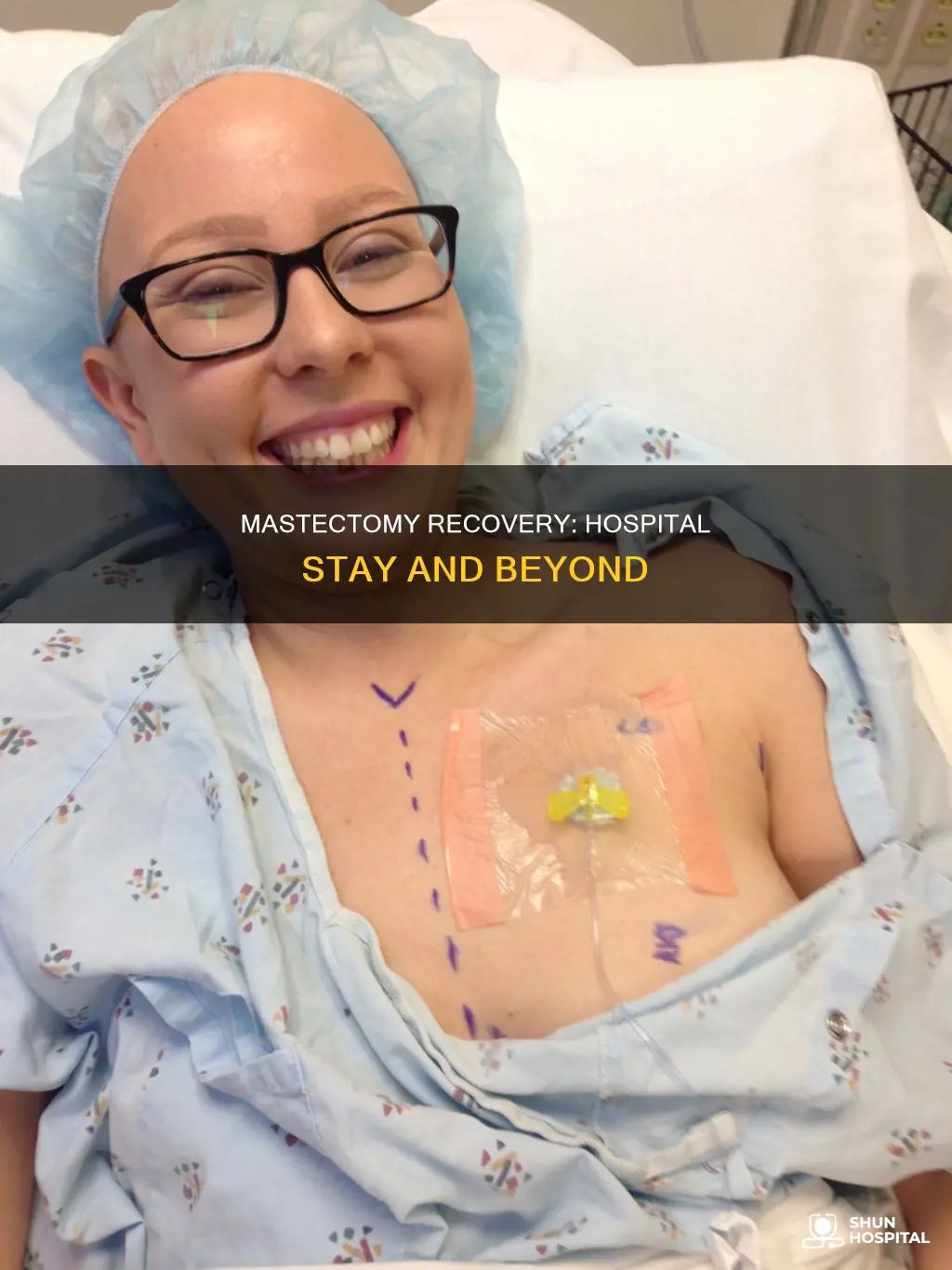 does a mastectomy require a hospital stay