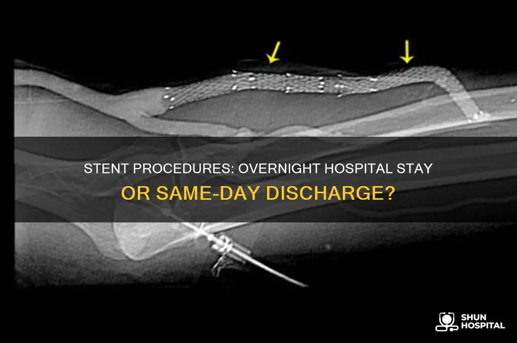 does a stent require an overnight stay in the hospital