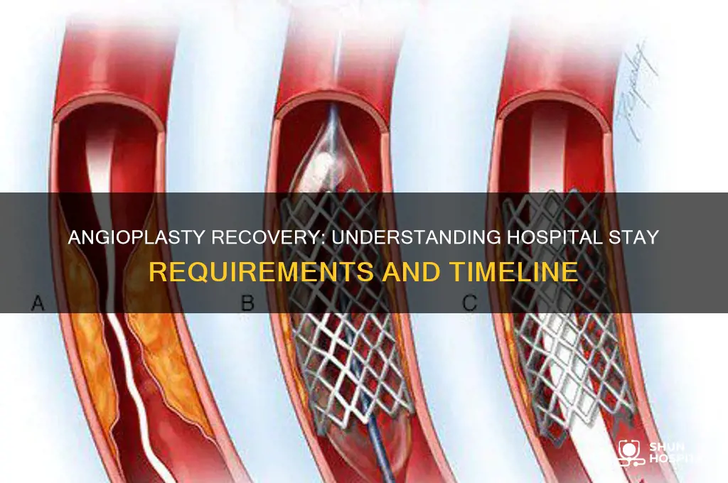 does angioplasty require hospital stay
