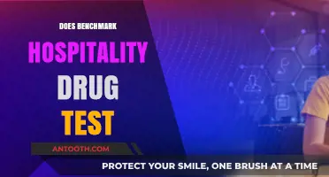 Does Benchmark Hospitality Conduct Drug Tests? What You Need to Know