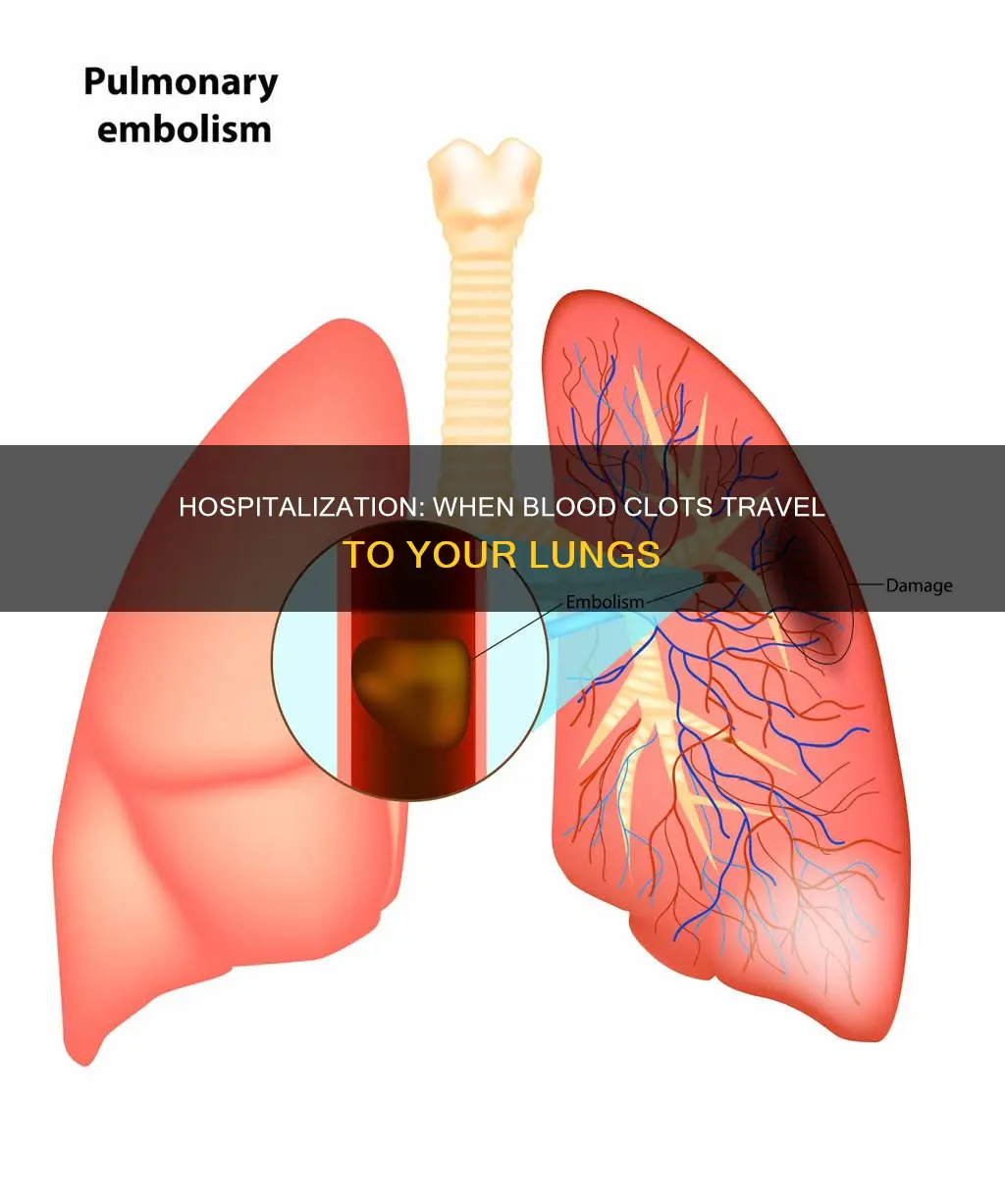 does blood clot in lung require hospitalization