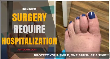 Bunion Surgery: Outpatient Procedure or Hospital Stay Required?