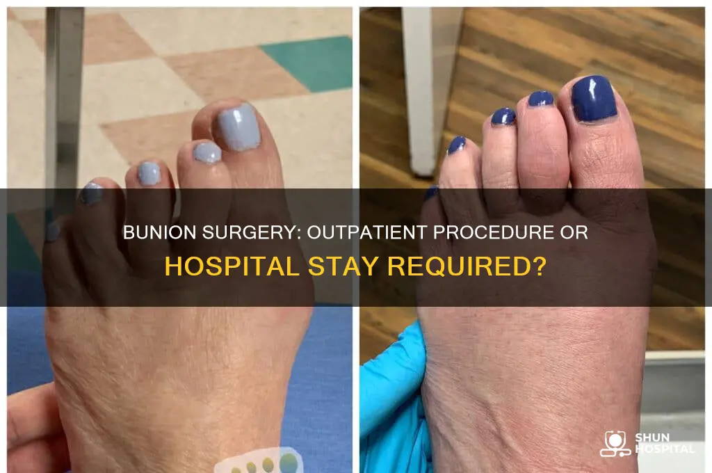 does bunion surgery require hospitalization