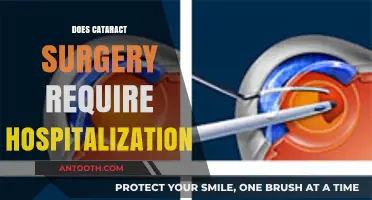 Cataract Surgery: Outpatient Procedure or Hospital Stay Required?