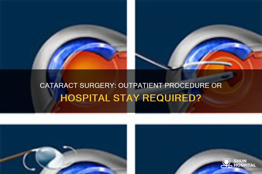does cataract surgery require hospitalization