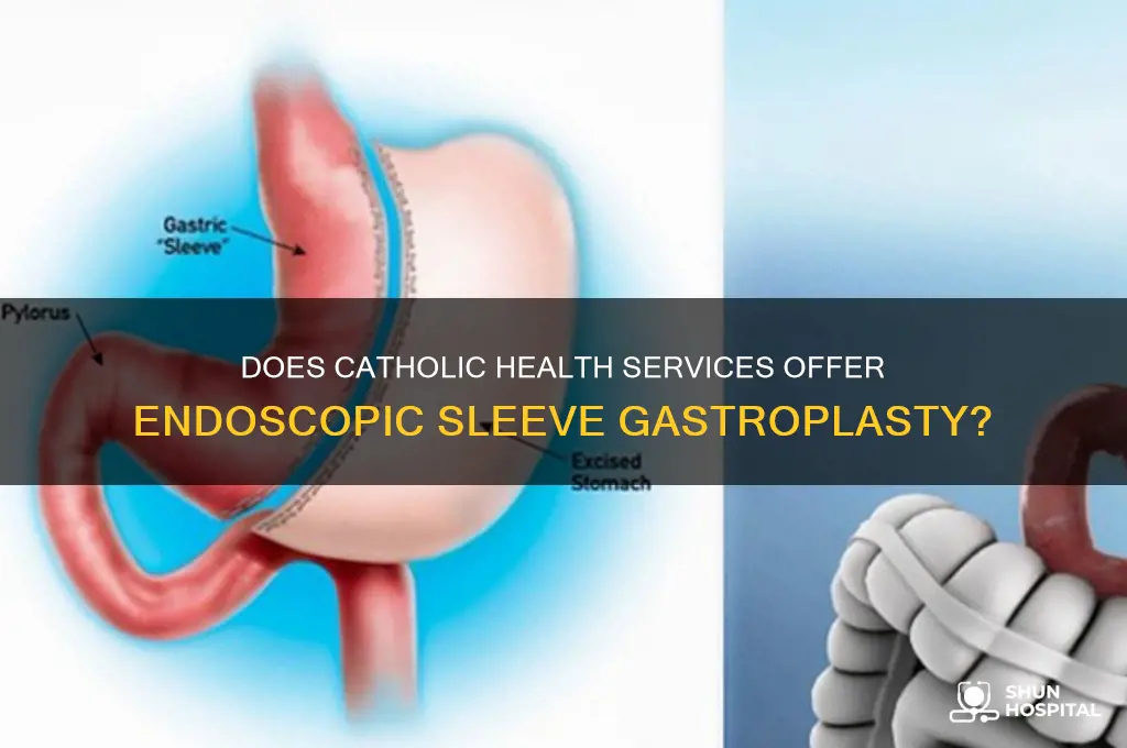 does catholic health service hospital perform endoscopic skeeve gastroplasty