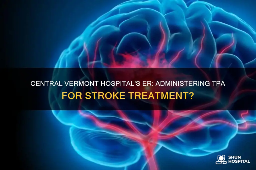 does central vermont hospital administer tpa in er for stroke