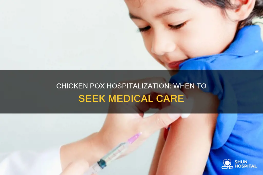 does chicken pox require hospitalization
