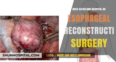 Cleveland Hospital: Esophageal Reconstruction Surgery Options