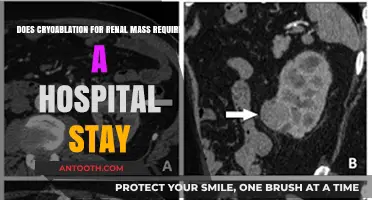 Cryoablation for Renal Mass: Hospital Stay Necessary or Outpatient Procedure?