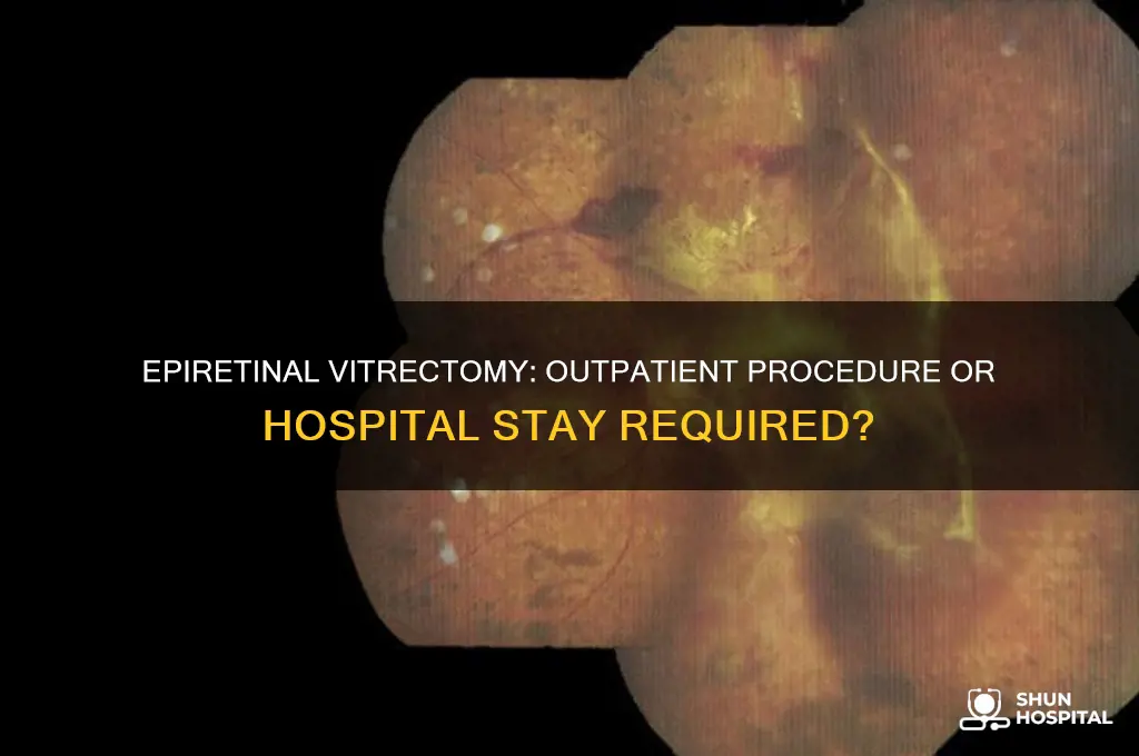 does epiretinal vitrectomy require hospitalization