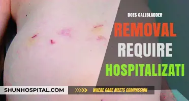 Gallbladder Removal Surgery: Hospital Stay or Outpatient Procedure?