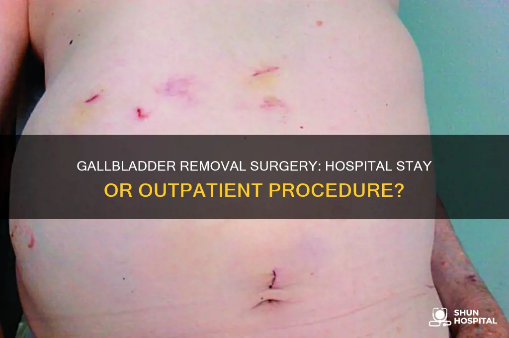 does gallbladder removal require hospitalization