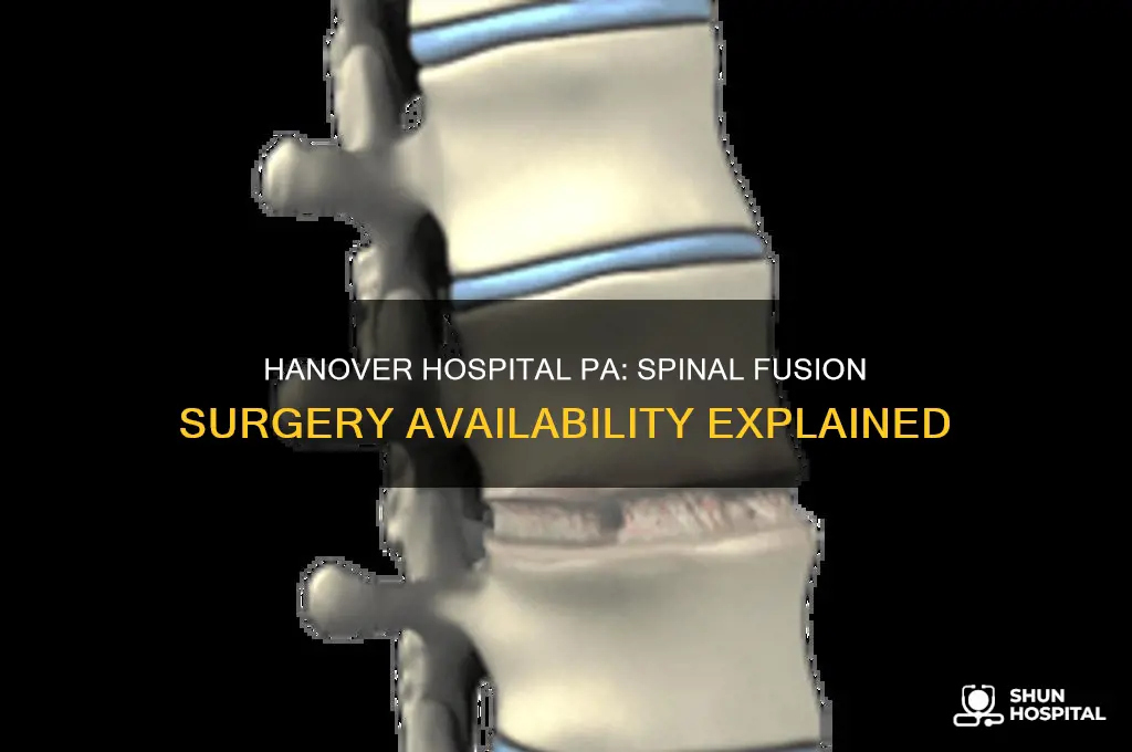 does hanover hospital in pa do spinal fusion surgery