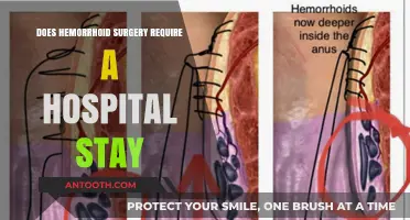 Hemorrhoid Surgery: Do You Need to Stay in Hospital?