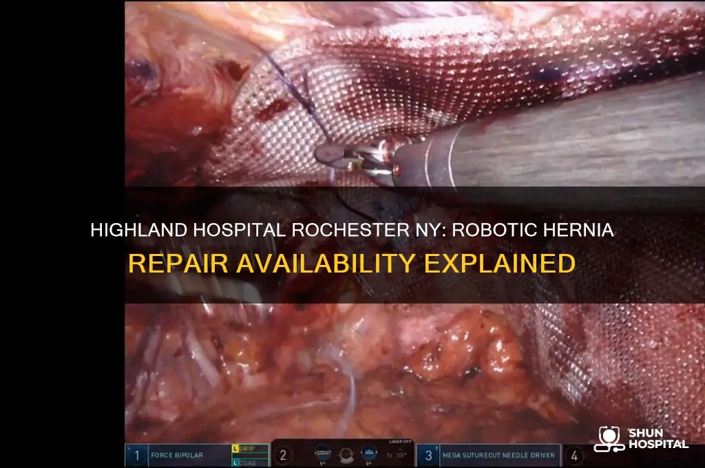 does highland hospital in rochester ny perform robotic hernia repair
