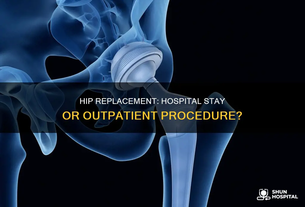 does hip replacement require overnight hospital stay