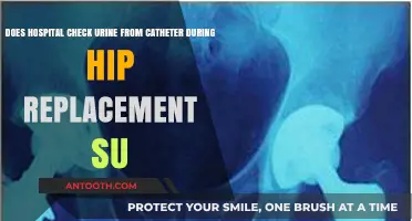 Urine Monitoring via Catheter During Hip Replacement Surgery: What to Expect