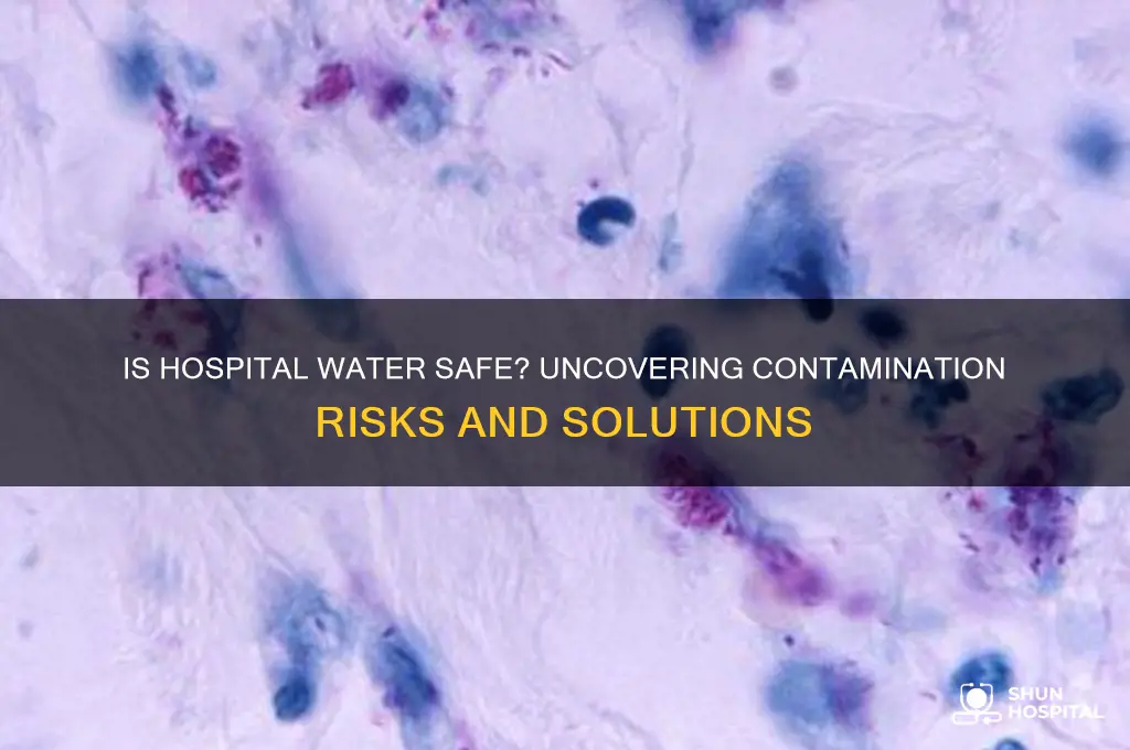 does hospital contsin contaminared water