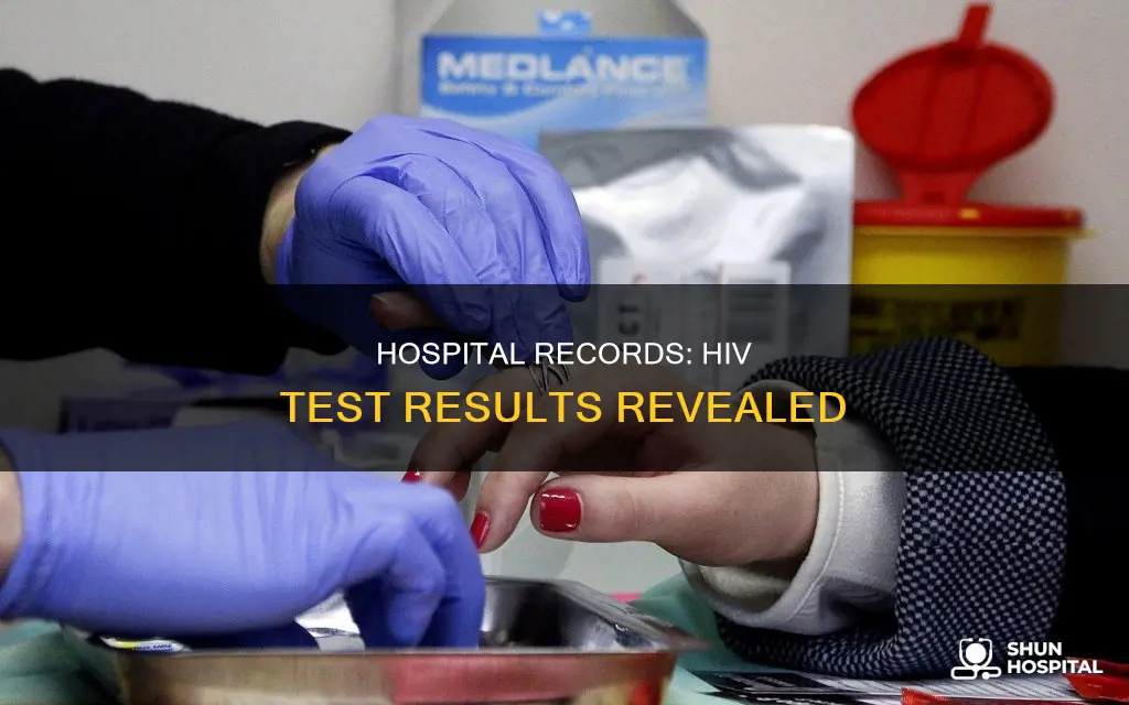 does hospital record show hiv test result