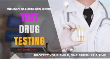Do Hospitals Require Blood or Urine Tests for Drug Testing?