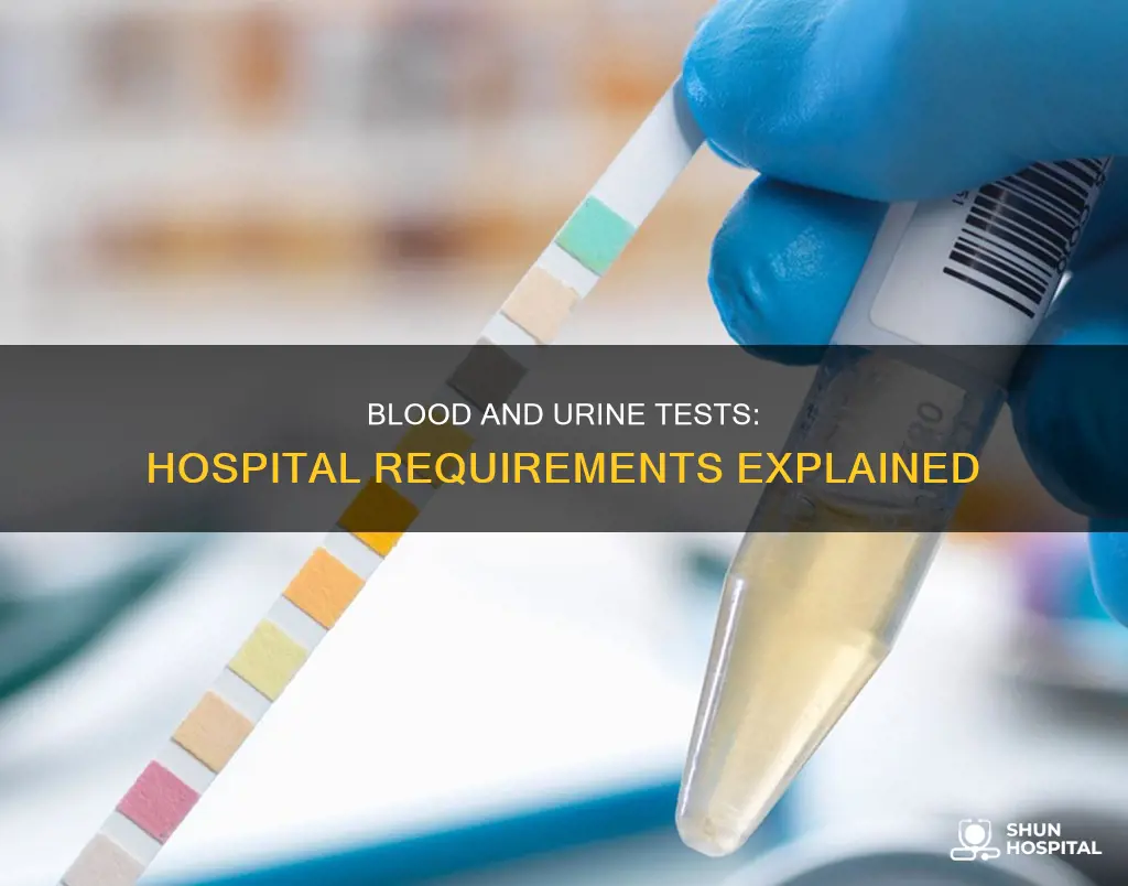 does hospitals require blood or urine test