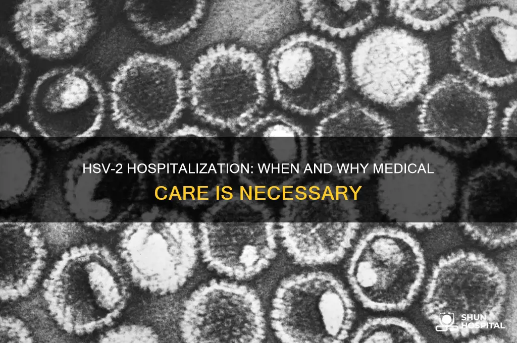 does hsv2 require hospitalization