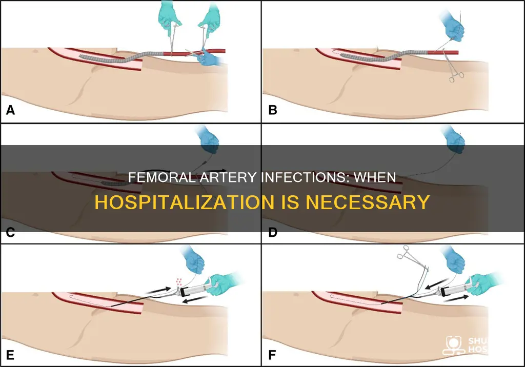 does infection at femoral artery require hospitalization