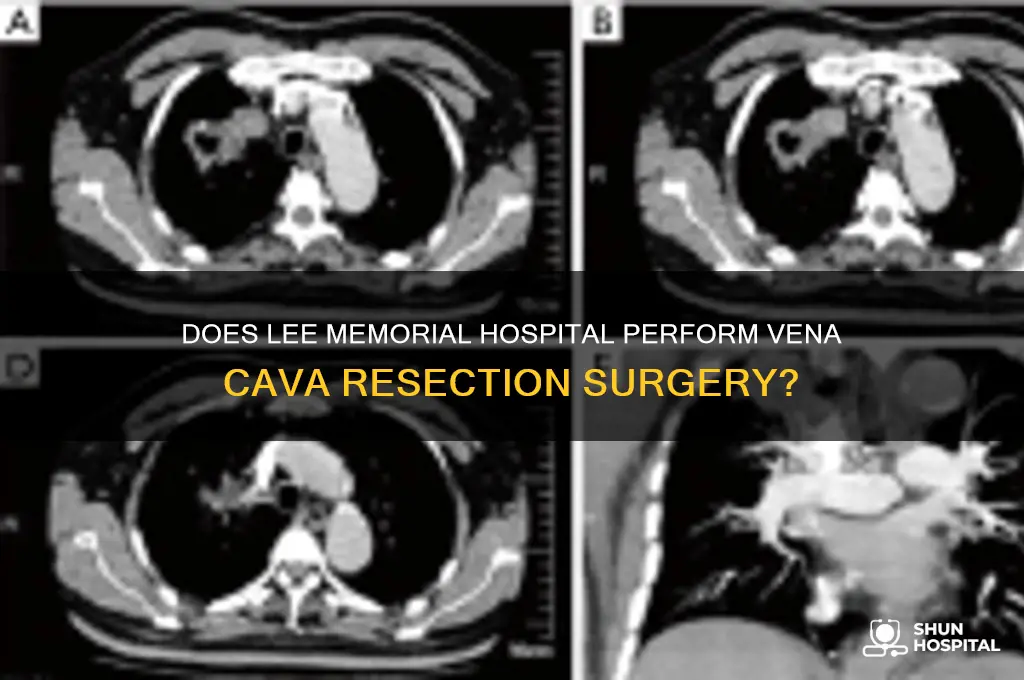 does lee memorial hospital do vena cava resection surgery