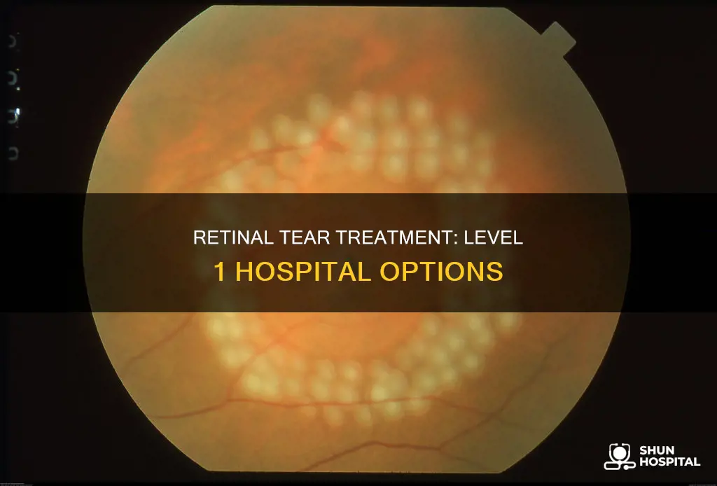 does level 1 hospital treat retinal tear