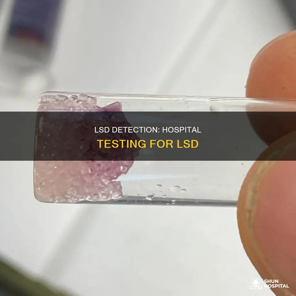 does lsd show up in hospital test