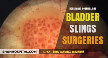 Mayo Clinic Bladder Slings Surgery: What You Need to Know