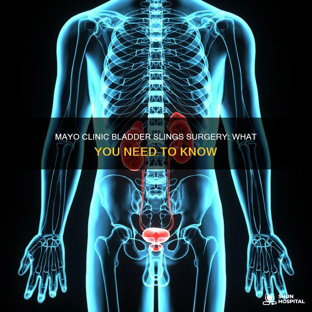 does mayo hospitals do bladder slings surgeries