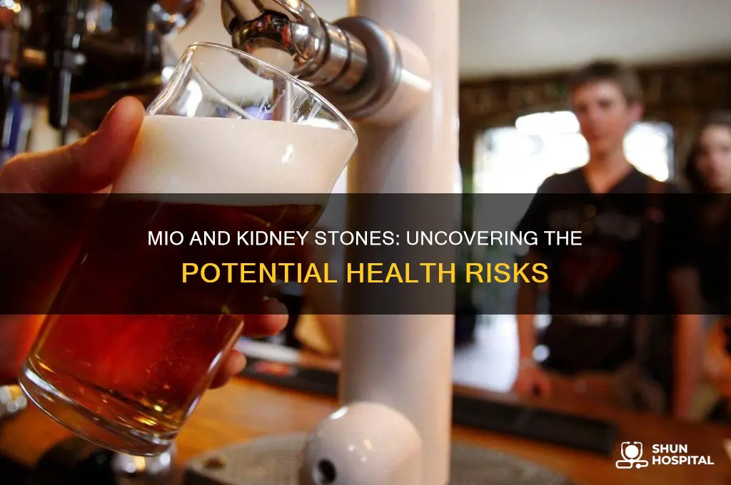 does mio cause kidney stones