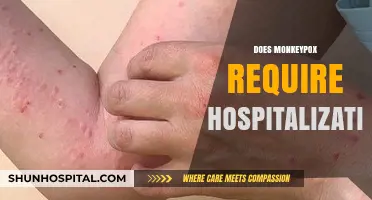 Monkeypox Hospitalization: When and Why Medical Care is Necessary