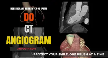 Novant Brunswick Hospital: CT Angiogram Availability