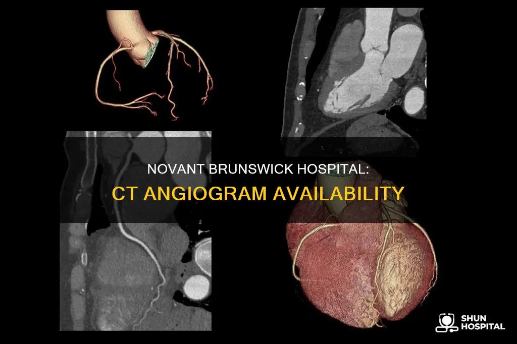 does novant brunswick hospital do ct angiogram