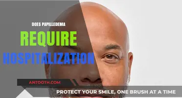 Papilledema Hospitalization: When Is It Necessary for Patient Care?